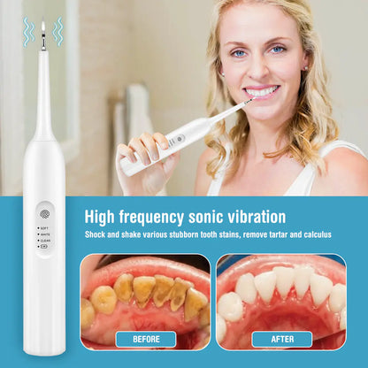 Smart Touch Screen Tooth Cleaner for Home Use